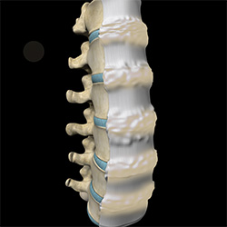 Fracture of the Thoracic and Lumbar Spine